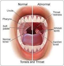 Image result for Adenodolichos