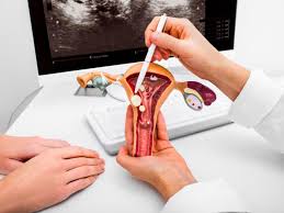 Nhuộm phiến đồ tế bào theo papanicolaou thực hiện rá sao?