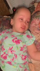 Robyn and Luna Hydrocephalus