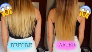 How long it takes for the hair to regrow is a commonly asked question that is often asked by men and women during their consultation process with us one of our recent patients kept a video diary where he tracked his recovery and how long his hair has taken to grow back after an fut hair transplant at. How To Grow Your Hair In 1 Day 2015 Youtube