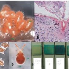 Trombicula akamushi (brumpt) in jars containing soil and supplied with resh vegetable matter. Pdf Absorption Of Host Hemolytic Fluid By Trombiculid Mites Acari Trom Biculidae