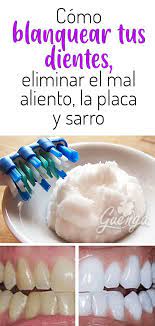 Despidete De Los Dientes Amarillos El Sarro Y El Mal Aliento Con Esta Pasta Casera Higiene Y Salud Salud Dental Salud Bucal