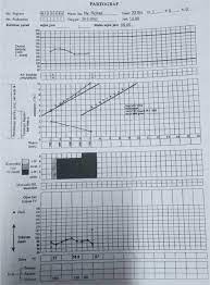Doc kasus 15 partograf partus lama nafisah putri academia edu. Tesis Perbandingan Partograf Berbasis Sistem Komputer Dan Partograf Konvensional Terhadap Pemantauan Pencatatan Pelaporan Kemajuan Persalinan Pdf Download Gratis