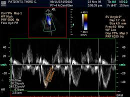 We did not find results for: Sante Dicom Viewer Mac Santesoft Ltd