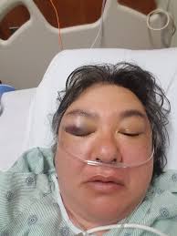 WWE Hall of Famer Ted DiBiase Suffers Fall At Airport; Black Eye & Bruised  Ribs Ted DiBiase recently went