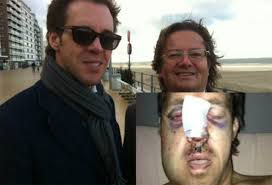 We would like to show you a description here but the site won't allow us. Marc Coucke Redde Vriend Na Jetski Ongeval