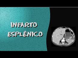 Não é enfarte ou angina:/é inveja do velho braga. (manuel bandeira, zeppelin em santa teresa in enfarte2 (en.far.te). Videoaula Radiologia Tomografia Computadorizada Infarto Esplenico Youtube