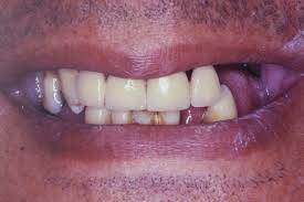 386 likes · 3 talking about this · 24 were here. Case Prosthetic Cases Dental Clinic L M