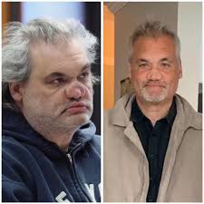 Do you remember Artie Lange from the Howard Stern show? He recently went  viral because of a picture of his deteriorated nose from over 3 decades of  drug abuse. Yesterday he posted