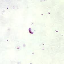 In smear test blood is seen under the microscope by an experienced doctor for malaria parasite. Cdc Dpdx Malaria