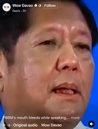 I heard some medical doctors have sounded the alarm about the President's  health— and frankly, the public has every right to be concerned. Several  videos have circulated showing potential signs of health