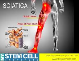 Pin On Chronic Pain