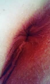 My girls asshole, close up. Smells great, especially after a whole day. Porn  Pic - EPORNER