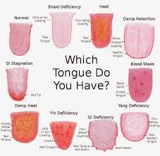 Mobile Site Preview Tongue Health Health Remedies Acupuncture