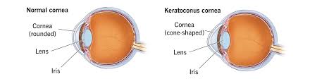Image result for Cornea