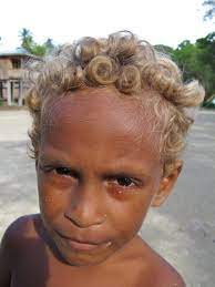 Such is the case for solomon islanders, where about 5 to 10% of the population is naturally blonde (by means of hair color) while otherwise dark skinned. Pin On Beautifully Created By God