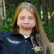 Despite their disabilities, sisters Ava and Jessa have become beauty  pageant queens 🙌