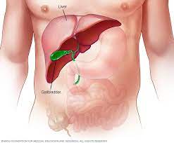 Jan 02, 2020 · you may have seen numerous literature and commercials about chronic hepatitis c (hcv) and for good reason. Hepatitis C Symptoms And Causes Mayo Clinic