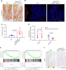 loss of bcl9 9l suppresses wnt driven tumourigenesis in