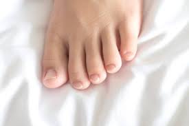 Image result for Clubbing nails feet