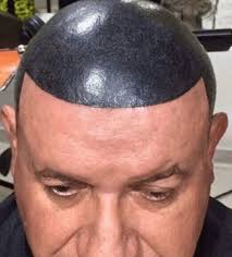View our award winning scalp micropigmentation videos showing our amazing results and see why we are voted number #1 in the world. Insanely Awful Hair Tattoo Fails Tattoo Ideas Artists And Models