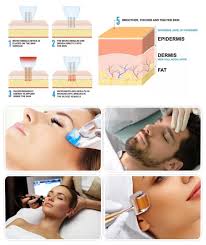 Jom buat hair removal treatment di marissa aesthetic melaka #marissa #hairremoval # . Hereme Hot Selling Derma Pen Anti Aging Nicotinamide Whitening And Moisturizing Facial China Skin Whitening Relieve Aging Of Skin Made In China Com