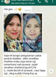 Set kecantikan shaklee cuma dua iaitu vitamin c dan vitamin e. Kulit Cantik Selepas Makan Set Cantik Shaklee Ziana Eunos