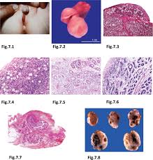 Image result for True Hermaphroditism