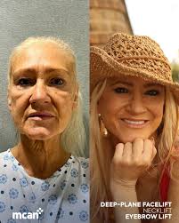 Marina's Rasional Holday: Sayıyorsun hasta 火 olcan MCAN için yapılan  mmaproveamin Mısırulu eğitncu danıştlinysan