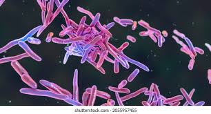 Image result for Erysipeloid