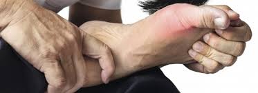 Was Darf Man Bei Gicht Essen