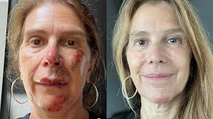 This street in St. Leonard keeps getting flooded during Montreal storms