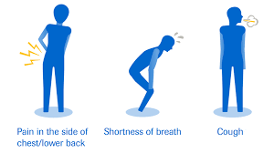 In stage 4, pleural mesothelioma metastasizes to distant sites in more than 10% of cases. Roche About Mesothelioma