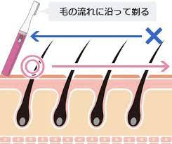 vio脱毛の事前処理はどこまで剃る 全剃り vio脱毛前の自己処理の正しいやり方マニュアル vio脱毛 脱毛 脱毛 クリニック