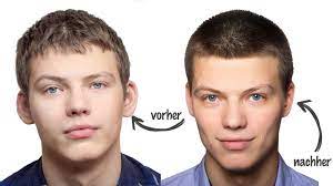 We did not find results for: Ohrenkorrektur Ohren Anlegen The Gentlemen S Clinic