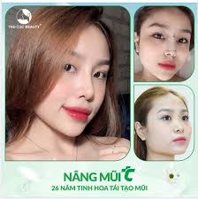 NÂNG MŨI KHÔNG ĐAU