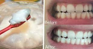 Une Nouvelle Revelation Scientifique L Huile De Coco Est Bien Meilleure Que Mille Dentifrice Voici Comment Le Preparer Kokosol Verwendung Gesundheit Zahne