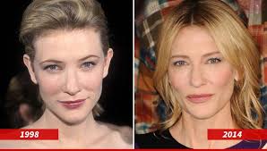 cate blanchett good genes or good docs botox cosmetic botox cosmetic surgery