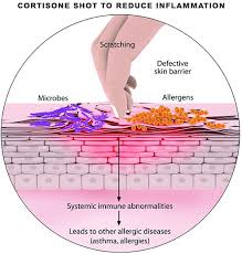 Image result for Cortisone