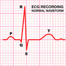 Para leer un electrocardiograma debemos de seguir un sistema, de tal forma que nunca se nos olvide nada y todos hablemos con. Como Hacer Un Electrocardiograma Y Nociones Basicas Sobre Como Interpretarlo Enfermeria Nursing