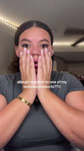 Allergic Reaction to Mary Kay