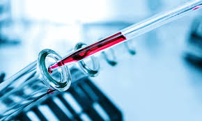 Victor velculescu at the johns hopkins kimmel cancer center investigated whether they could detect circulating dna from early tumors. New Blood Test Can Detect Fifty Types Of Cancer And Can Identify Patients When They Have No Symptoms Daily Mail Online