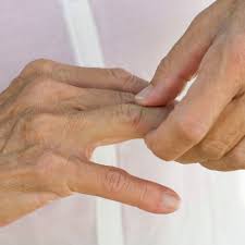 Our researchers talked to 40 young people and 10 parents in their own homes. How To Get Rid Of Arthritis In Fingers