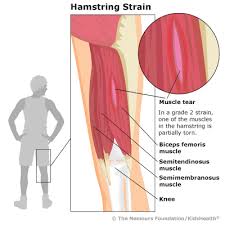 Quad leg muscles anatomy labeled diagram, vector illustration fitness poster. Hamstring Strain For Teens Nemours Kidshealth