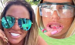 Katie price plastic surgery | katie price before and after veneers. Katie Price Is Left Horrified As Her Brand New Veneers Fall Out Daily Mail Online