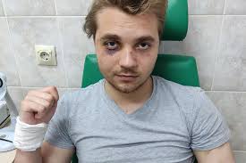 Abused by Police in Belarus: Faces, Stories