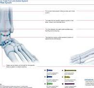 MT Cuboid Locking Plate,Ankle Foot Fracture Plate