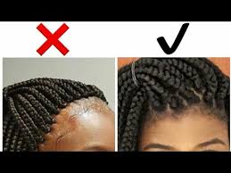 Sorry, your blog cannot share posts by email. Tips For Avoiding And Taking Care Of Braid Bumps Igbocurls