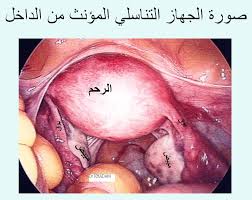 ملف كامل عن الرحم بالصور الصفحة 2 عالم حواء