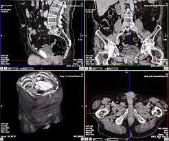 Can cats detect cancer in their humans? Ct Scan Or Cat Scan How Does It Work